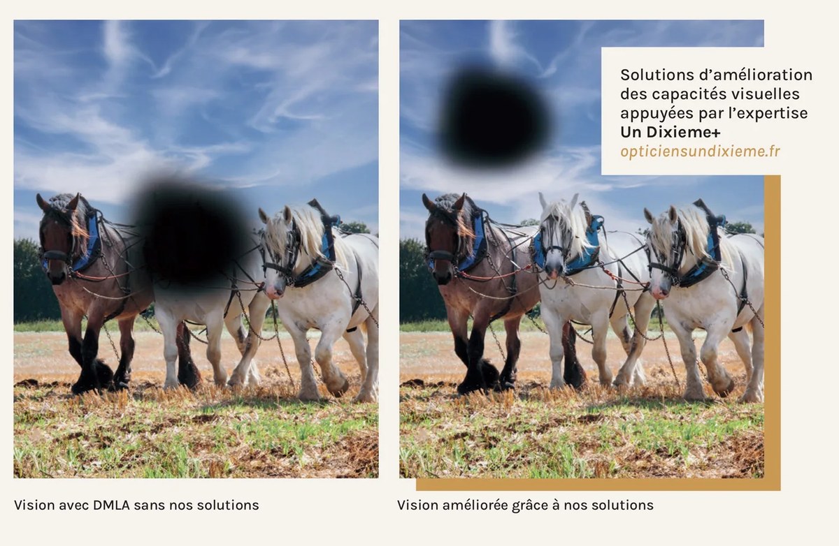Comparaison de vision liée à la DMLA : à gauche, vision altérée sans solution ; à droite, vision améliorée grâce aux solutions Pigeard et au réseau Un Dixième+